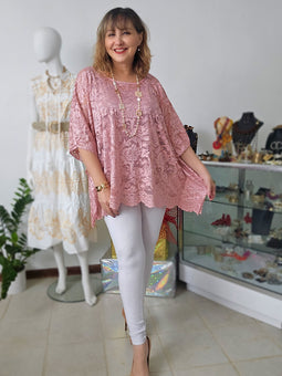 Enchanting lace tunic